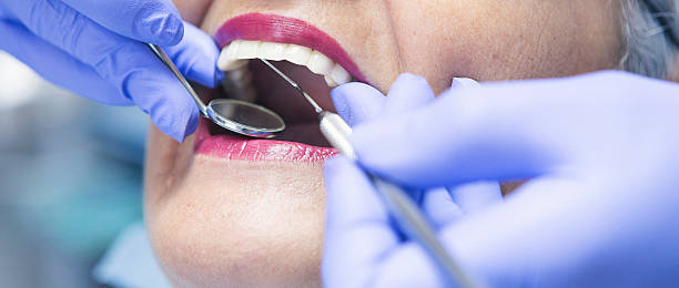 Best Emergency Root Canal Treatment in Franklin, GA